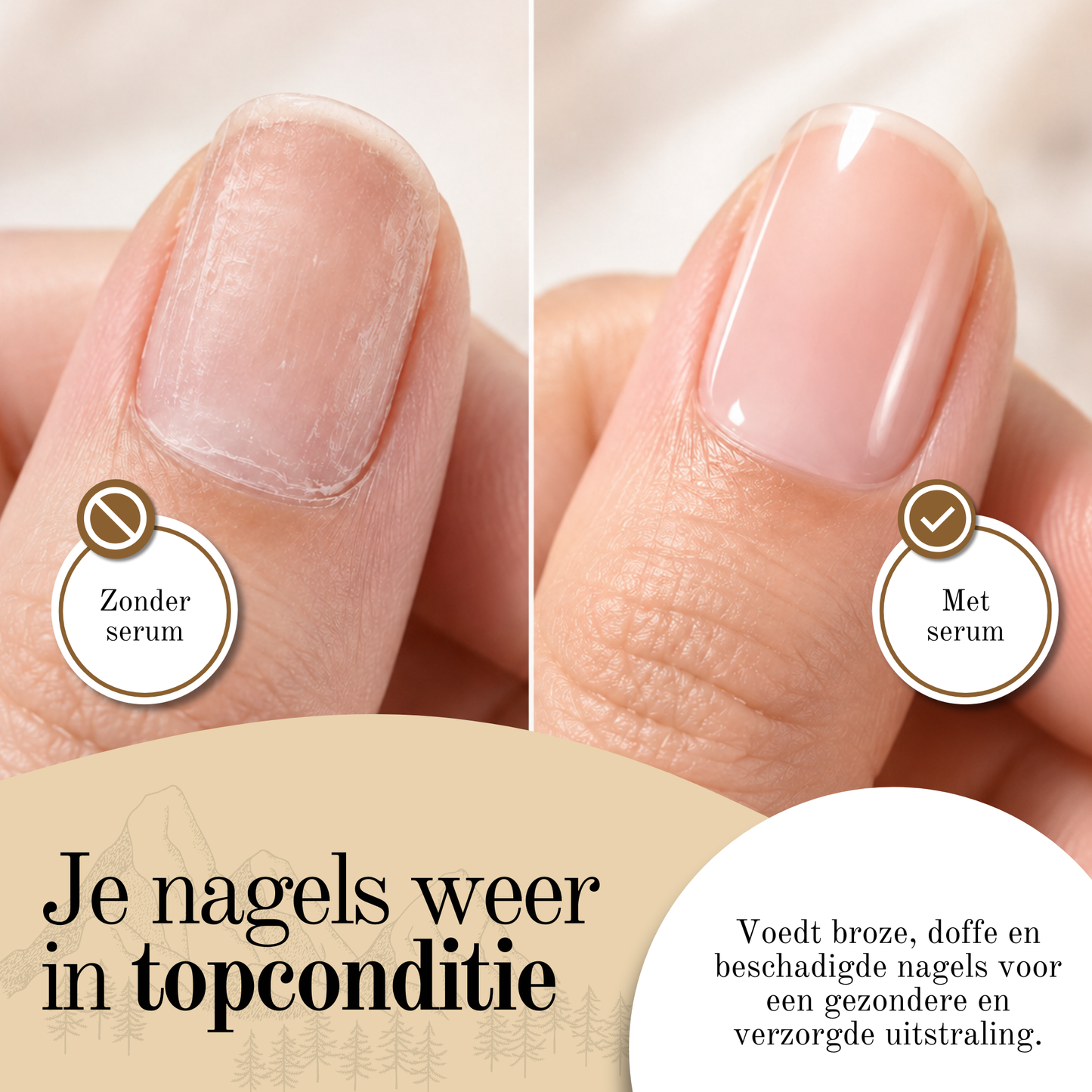 Rélum® Nagelschimmel behandeling serum